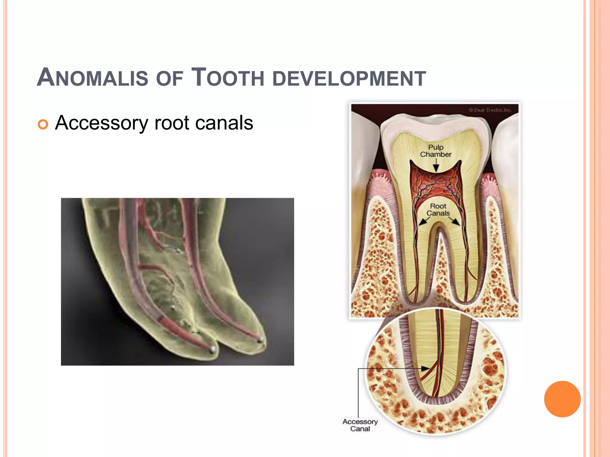 LATE (ADVANCED) BELL STAGE