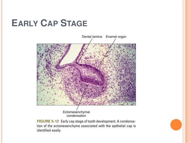 Tooth development part 2 diagram of tooth 31 