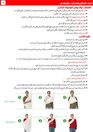 *:‫األمل‬ً‫ا‬‫حذر‬‫فكن‬‫لعقلي‬‫ا‬‫االضطراب‬‫أو‬‫لعصب‬‫ا‬‫يف‬‫إصابة‬‫أو‬‫ية‬‫و‬‫ق‬‫مسكنات‬‫تناول‬‫لة‬‫ا‬‫ح‬‫يف‬‫األمل‬‫خيتفي‬‫أن‬‫ميكن‬‫و‬‫لكسر‬‫ا‬ ‫حدو‬‫مكان‬‫يف‬ ‫حيد‬
*:‫لقوة‬‫ا‬‫فقدان‬‫املكسورة‬‫ليد‬‫ا‬‫ب‬‫شيء‬‫أي‬‫رفع‬‫على‬‫لقدرة‬‫ا‬‫عدم‬‫مثل‬
*:‫طبيعية‬‫غري‬‫حركة‬‫لتحرك‬‫ا‬‫من‬‫لكسر‬‫ا‬‫ملنع‬‫خاصة‬‫ية‬‫ا‬‫عن‬‫يض‬‫ر‬‫امل‬‫يعطى‬‫أن‬‫جيب‬‫و‬‫مستقر‬‫غري‬‫نه‬‫أ‬‫ب‬‫لكسور‬‫ا‬‫من‬‫لنوع‬‫ا‬‫هذا‬‫يوصف‬
*‫ظهور‬‫ّم‬‫ر‬‫تو‬‫أو‬‫كدمة‬‫لكسر‬‫ا‬‫مكان‬‫حول‬
*:‫تشوه‬‫خاطئ‬‫بشكل‬‫مثنية‬‫املكسورة‬‫لساق‬‫ا‬‫تكون‬‫إذ‬
*:‫املنتظم‬‫غري‬‫لشكل‬‫ا‬‫يف‬‫لعظم‬‫ا‬‫سطح‬‫طول‬‫على‬‫اخنفاضات‬‫أو‬‫نتوءات‬‫تظهر‬‫حيث‬‫املكان‬‫املكسورتان‬‫احلافتان‬‫فيه‬‫تتالقى‬‫لذي‬‫ا‬
*:‫فرقعة‬‫بعضها‬‫على‬‫املكسورة‬‫لعظمية‬‫ا‬‫احلواف‬‫باحتكاك‬‫نسمع‬‫و‬‫نشعر‬‫حيث‬
*:)‫يالم‬‫إ‬(‫مضض‬‫اإلصابة‬ ‫حدو‬‫مكان‬‫يف‬
*‫لتحرك‬‫ا‬‫عدم‬‫منه‬‫اطلب‬‫و‬‫يض‬‫ر‬‫امل‬‫هدئ‬
*‫يض‬‫ر‬‫امل‬‫يقوم‬‫أن‬‫ميكن‬‫و‬‫جيد‬‫بشكل‬‫مثبتة‬‫تصبح‬‫حتى‬‫يك‬‫د‬‫بي‬‫ساكنة‬‫اإلصابة‬‫تبقي‬‫أن‬‫حاول‬‫بنفسه‬‫لشيء‬‫ا‬‫هبذا‬
*‫للخطر‬ً‫ا‬‫معرض‬‫كان‬‫إذا‬‫إال‬‫مثبتة‬‫اإلصابة‬‫تصبح‬‫حتى‬‫يض‬‫ر‬‫امل‬‫حترك‬‫ال‬
*‫ا‬‫على‬‫حتافظ‬‫أن‬‫حاول‬‫اإلسعاف‬‫سيارة‬‫تنتظر‬‫كنت‬‫إذا‬‫أ‬‫بربط‬‫تقم‬‫وال‬‫فحسب‬‫ساكنة‬‫إلصابة‬‫املصاب‬‫لطرف‬‫ا‬‫حول‬)‫عصابة(جبرية‬‫ي‬
‫اجلروح‬‫بتغطية‬‫(قم‬)‫معقم‬‫بضماد‬‫املفتوحة‬
*‫تسمح‬‫ال‬ً‫ا‬‫جراحي‬ً‫ال‬‫عم‬‫حيتاج‬‫أن‬‫ميكن‬‫نه‬‫أل‬‫يشرب‬‫أو‬‫يأكل‬‫بأن‬‫يض‬‫ر‬‫للم‬
*‫ي‬‫أ‬‫نظر‬‫ا‬(‫لرأس‬‫ا‬‫إصابات‬:‫إىل‬ً‫ا‬‫ض‬‫لصفحتان‬‫ا‬01‫و‬03),(‫ئب‬‫ا‬‫لس‬‫ا‬‫لصدر‬‫ا‬‫ل‬‫ا‬‫صفحة‬10),(‫لشوكي‬‫ا‬‫احلبل‬‫إصابات‬‫لصفحتان‬‫ا‬39‫و‬41)
-:‫لعلوي‬‫ا‬‫لطرف‬‫ا‬‫يف‬‫اإلصابة‬‫نت‬‫ا‬‫ك‬‫إذا‬
*‫احل‬‫تستخدم‬‫حيث‬‫لة‬‫ا‬ّ‫مح‬‫يف‬‫لذراع‬‫ا‬‫بتثبيت‬‫قم‬‫لرتقوة‬‫ا‬‫أو‬‫لساعد‬‫ا‬‫إصابات‬‫لتثبيت‬‫عادة‬‫لداعمة‬‫ا‬‫لة‬‫ا‬ّ‫م‬
*‫أو‬‫لتنفس‬‫ا‬‫يف‬‫صعوبة‬‫من‬‫ني‬‫ا‬‫يع‬‫يض‬‫ر‬‫امل‬‫كان‬‫أو‬ً‫ا‬‫متضرر‬‫املصاب‬‫لطرف‬‫ا‬‫يف‬‫األعصاب‬‫أو‬‫لدوران‬‫ا‬‫كان‬‫أو‬‫مربح‬‫أمل‬‫من‬‫ني‬‫ا‬‫يع‬‫يض‬‫ر‬‫امل‬‫كان‬‫إذا‬‫مما‬ً‫ا‬‫متأكد‬‫تكن‬‫مل‬‫إن‬
‫باإلسعاف‬‫اتصل‬‫فعله‬‫عليك‬
*‫إىل‬‫يض‬‫ر‬‫امل‬‫نقل‬‫حاول‬‫املشفى‬
-:‫لسفلي‬‫ا‬‫لطرف‬‫ا‬‫يف‬‫اإلصابة‬‫نت‬‫ا‬‫ك‬‫إذا‬
*ً‫ا‬‫دافئ‬‫و‬ً‫ا‬‫ساكن‬‫يض‬‫ر‬‫امل‬‫وأبق‬‫باإلسعاف‬‫اتصل‬
*‫املصاب‬‫لطرف‬‫ا‬‫ب‬‫لسليم‬‫ا‬‫لطرف‬‫ا‬‫تربط‬‫عصابة‬‫باستخدام‬‫اإلصابة‬‫ثبت‬)ً‫ال‬‫مث‬‫ئية‬‫ا‬‫ن‬‫منطقة‬‫يف‬ً‫ا‬‫موجود‬‫كنت‬‫(إذا‬‫سيتأخر‬‫اإلسعاف‬‫كان‬‫إذا‬
*‫لذي‬‫ا‬‫املكان‬‫يف‬‫لدوران‬‫ا‬‫جهاز‬‫سالمة‬‫من‬‫تأكد‬‫األمر‬‫استدعى‬‫إذا‬‫لعصابة‬‫ا‬‫بإرخاء‬‫قم‬.‫لسفلي‬‫ا‬‫لطرف‬‫ا‬‫حول‬‫مربوطة‬‫عصابة‬‫أي‬‫أو‬‫اإلصابة‬‫يلي‬
38
‫املعلق‬‫لدعم‬‫ا‬‫وشاح‬
‫املعلق‬‫لرفع‬‫ا‬‫وشاح‬
 