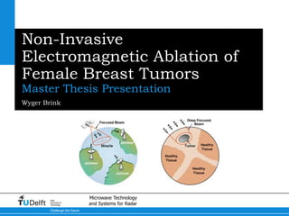 Non-Invasive Electromagnetic Ablation of Female Breast Tumors Master Thesis Presentation Wyger Brink 