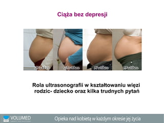 Ciąża bez depresji
Rola ultrasonografii w kształtowaniu więzi
rodzic- dziecko oraz kilka trudnych pytań
 