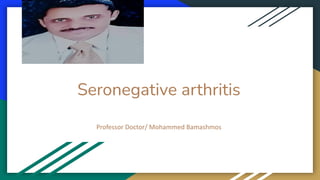 Seronegative arthritis
 