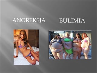 ANOREKSJA BULIMIA 