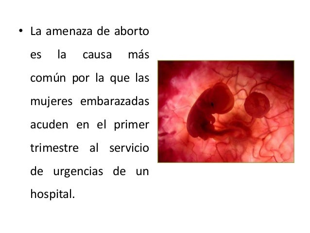 Amenaza de aborto