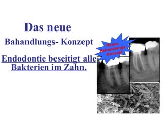 Wurzelkanalbehandlung (Stand: 06/2007) 