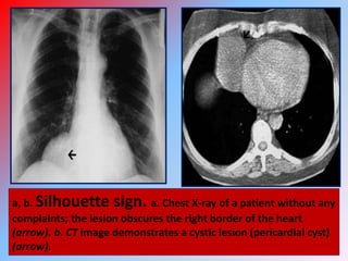 X.ray pearls 1 | PPTX