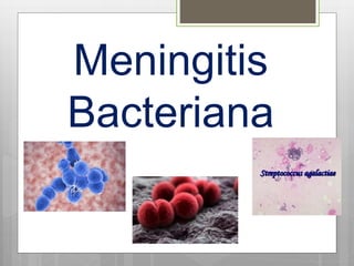 Meningitis
Bacteriana
 