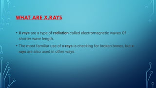 WHAT ARE X.RAYS
• X-rays are a type of radiation called electromagnetic waves Of
shorter wave length.
• The most familiar use of x-rays is checking for broken bones, but x-
rays are also used in other ways.
 