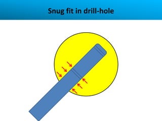 Snug fit in drill-hole
 