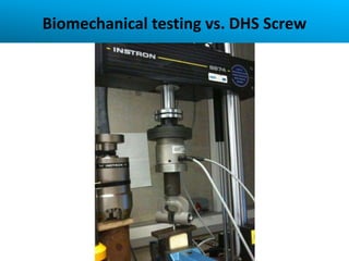 Biomechanical testing vs. DHS Screw
 