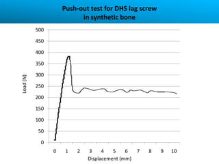 Push-out test for DHS lag screw
                           in synthetic bone
           500

           450

           400

           350

           300
Load (N)




           250

           200

           150

           100

           50

             0
                 0    1   2   3     4   5    6  7   8   9   10
                              Displacement (mm)
 