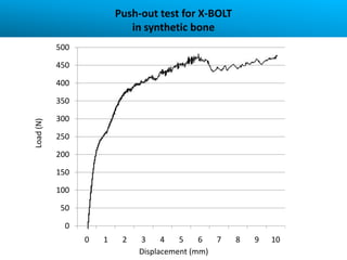 Push-out test for X-BOLT
                            in synthetic bone
           500

           450

           400

           350

           300
Load (N)




           250

           200

           150

           100

           50

             0
                 0   1    2   3     4   5    6  7   8   9   10
                              Displacement (mm)
 
