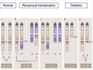 Normal

Reciprocal translocation

Deletion

 