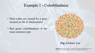 • Most types are caused by a gene
located on the X chromosome
• Red green colorblindness is the
most common type
Fig: Ishihara Test
Reference: Troscianko T, Benton CP, Lovell PG, Tolhurst DJ, Pizlo ZPhilos Trans R Soc
Lond B Biol Sci. on visual perception. 2009 Feb 27; 364(1516):449-61.[PubMed]
Example 1 - Colorblindness
 
