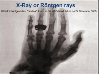 • Presentación
X-Ray or Röntgen rays
Wilhelm Röntgen's first "medical" X-ray, of his wife's hand, taken on 22 December 1895
 