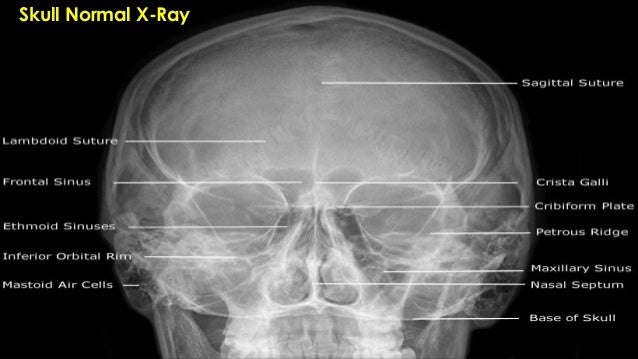number bone atomic X Ray significance of in Homoeopathy