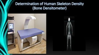 Determination of Human Skeleton Density
(Bone Densitometer)
 
