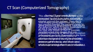 CT Scan (Computerized Tomography)
During CT scan work, X-rays
generated by the X-ray tube and emitt
rotated around the patient. Then the X-
rays passed through the patient's body to
the detector, which is highly dependent on
the type and model of the CT scanner,
probably consisting of xenon gas ionization
or crystal (such as cesium-iodine or
cadmium-tungsten). During one rotation
detector generates an electrical signal,
which is generated after X-ray irradiation
This electrical signal is transferred to the
computer, processed and reconstructed
into images using algorithms that have
been previously programmed. Each round
of the X-ray tube and detector
reconstructed into images that are
referenced as slices. Presented in the form
of cross-sectional slices of the detailed
anatomy of the body, and allows the
anatomical arrangement can be visualized.
 