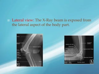  Lateral view: The X-Ray beam is exposed from
the lateral aspect of the body part.
 