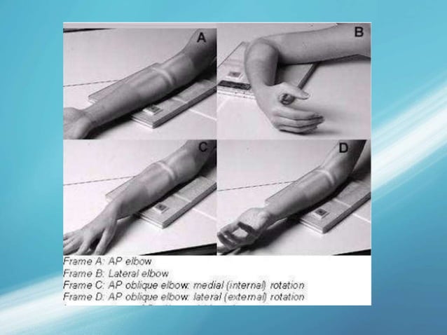 X-Ray | PPTX