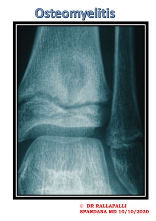 © DR RALLAPALLI
SPANDANA MD 10/10/2020
 