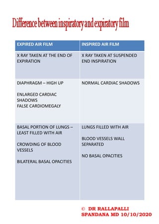 © DR RALLAPALLI
SPANDANA MD 10/10/2020
EXPIRED AIR FILM INSPIRED AIR FILM
X RAY TAKEN AT THE END OF
EXPIRATION
X RAY TAKEN AT SUSPENDED
END INSPIRATION
DIAPHRAGM – HIGH UP
ENLARGED CARDIAC
SHADOWS
FALSE CARDIOMEGALY
NORMAL CARDIAC SHADOWS
BASAL PORTION OF LUNGS –
LEAST FILLED WITH AIR
CROWDING OF BLOOD
VESSELS
BILATERAL BASAL OPACITIES
LUNGS FILLED WITH AIR
BLOOD VESSELS WALL
SEPARATED
NO BASAL OPACITIES
 