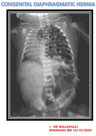 © DR RALLAPALLI
SPANDANA MD 10/10/2020
 