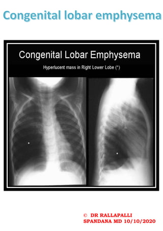 © DR RALLAPALLI
SPANDANA MD 10/10/2020
 
