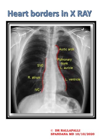 © DR RALLAPALLI
SPANDANA MD 10/10/2020
 