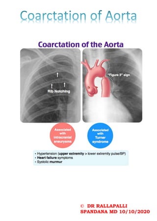 © DR RALLAPALLI
SPANDANA MD 10/10/2020
 