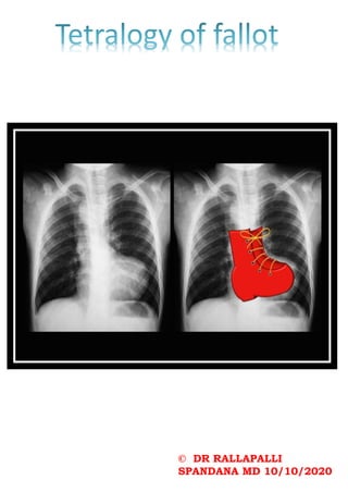 © DR RALLAPALLI
SPANDANA MD 10/10/2020
 