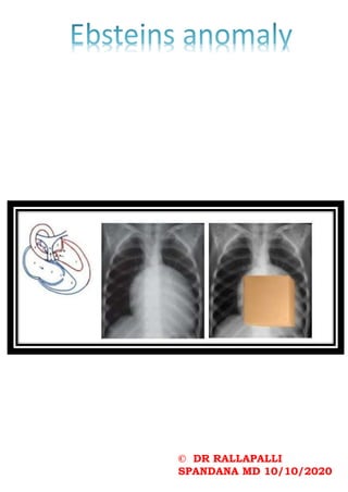 © DR RALLAPALLI
SPANDANA MD 10/10/2020
 