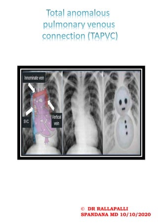 © DR RALLAPALLI
SPANDANA MD 10/10/2020
 