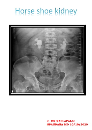 © DR RALLAPALLI
SPANDANA MD 10/10/2020
 