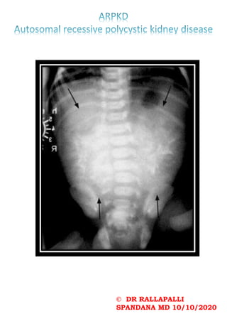 © DR RALLAPALLI
SPANDANA MD 10/10/2020
 