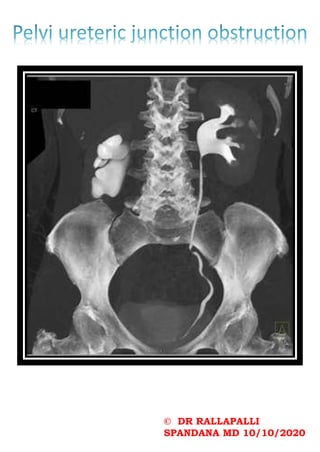 © DR RALLAPALLI
SPANDANA MD 10/10/2020
 