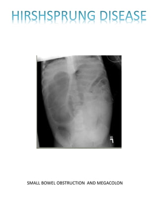 SMALL BOWEL OBSTRUCTION AND MEGACOLON
 