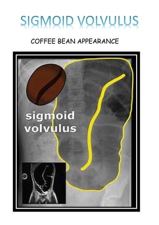 COFFEE BEAN APPEARANCE
 