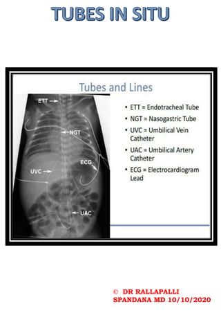 © DR RALLAPALLI
SPANDANA MD 10/10/2020
 