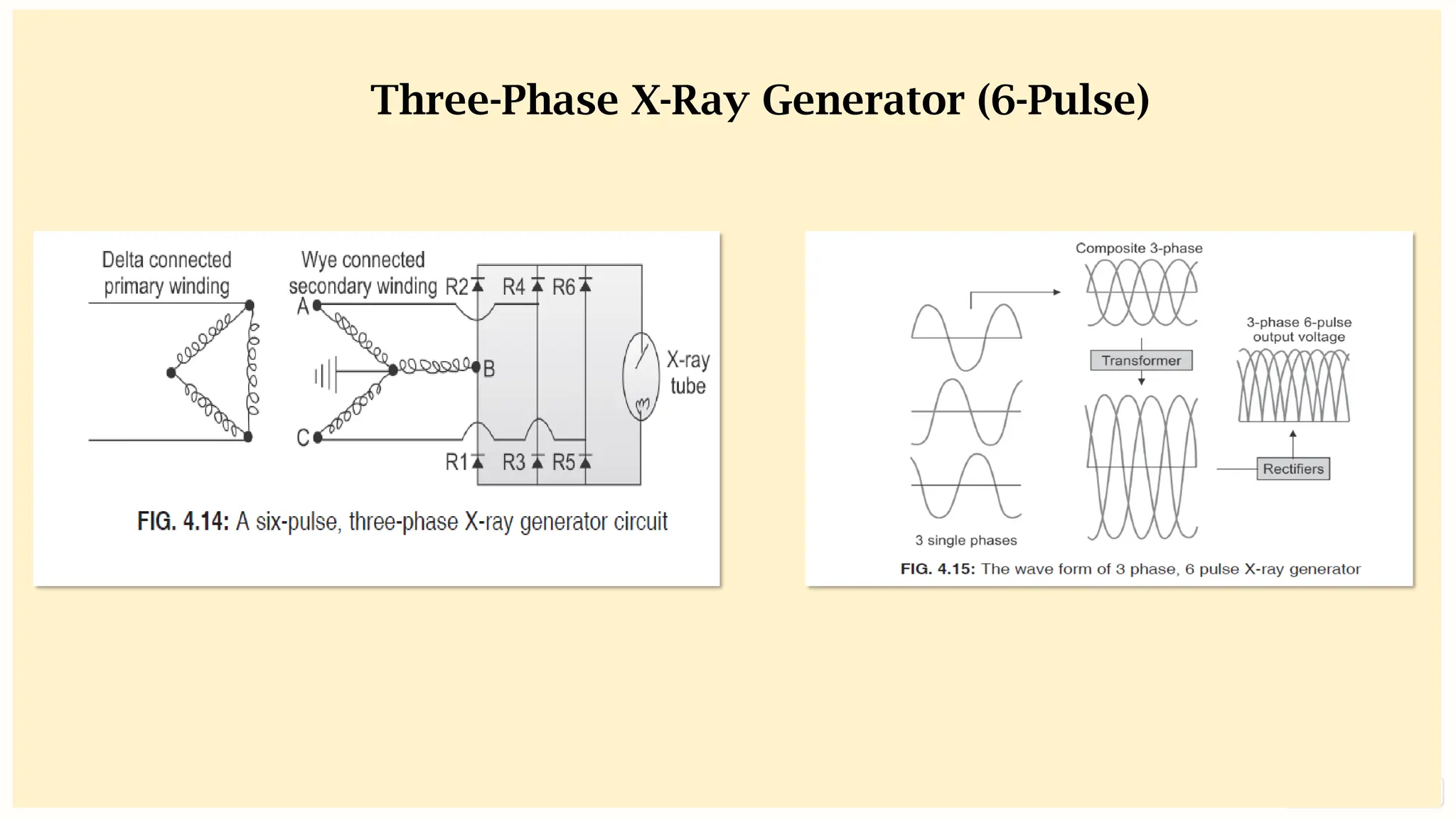 preencoded.png
Three-Phase X-Ray Generator (6-Pulse)
 