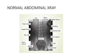 Comprehensive Guide To Abdominal X Ray Interpretation And Clinical comprehensive-guide-to-abdominal-x-ray-interpretation-and-clinical