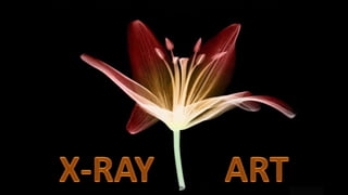 X-RAY        ART 