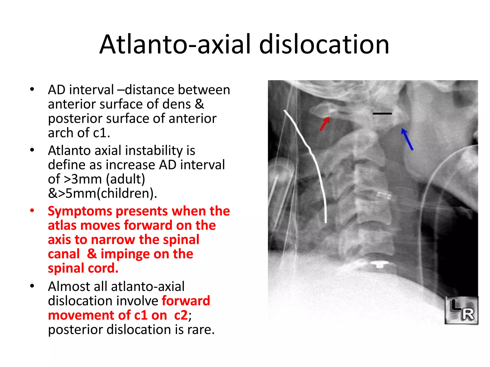 X Ray C Spine Pptx 