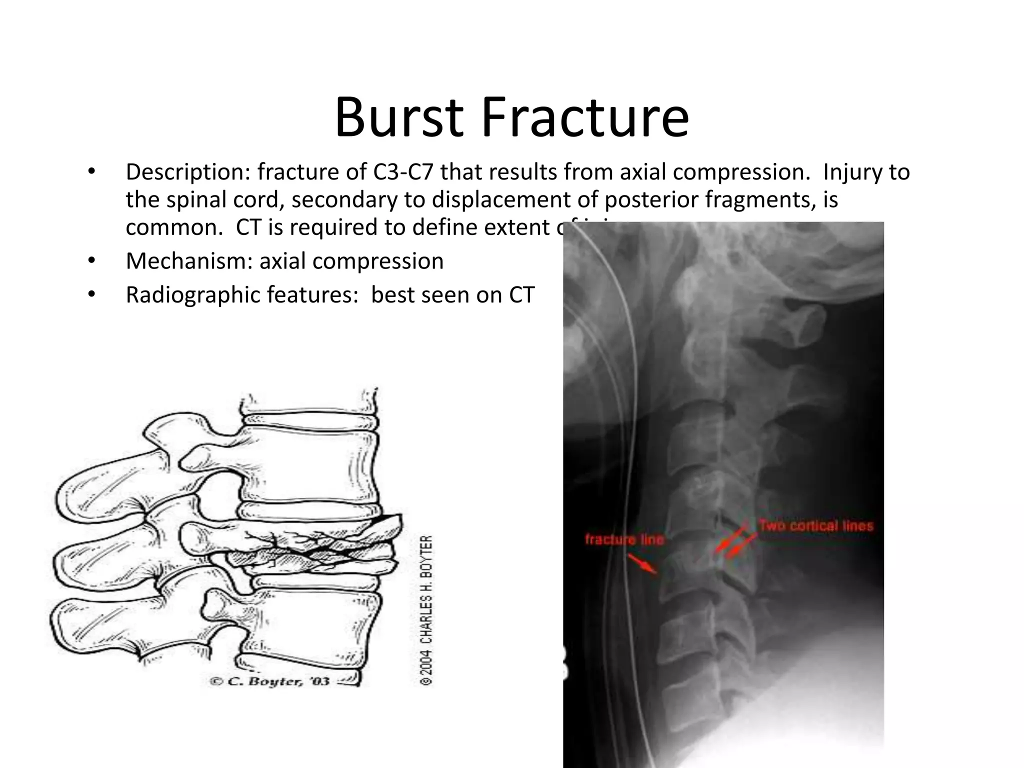 X ray c-spine | PPTX