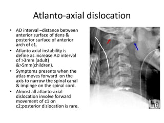 X ray c-spine | PPTX