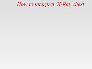 How to interpret X-Ray chest
 