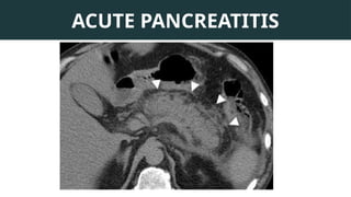 X-Ray & CT in Acute Abdomen-Radiology.pptx