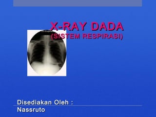 X-RAY DADAX-RAY DADA
(SISTEM RESPIRASI)(SISTEM RESPIRASI)
Disediakan Oleh :Disediakan Oleh :
NassrutoNassruto
 