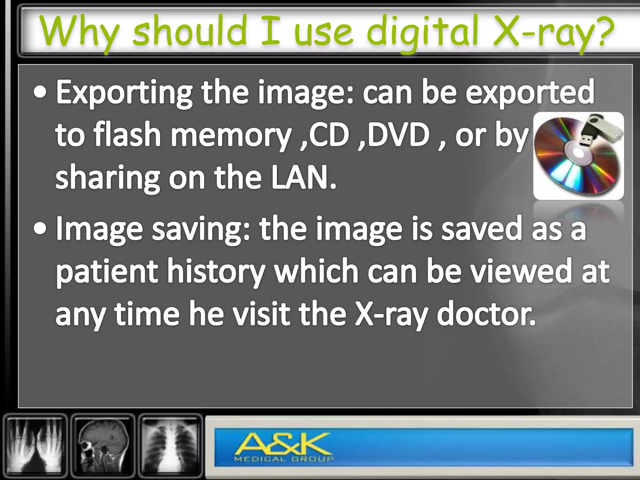 Why should I use digital X-ray?
