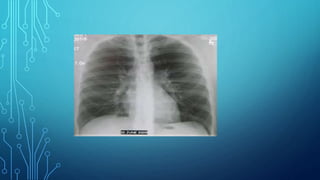 X-ray diagnostic methods.pptx